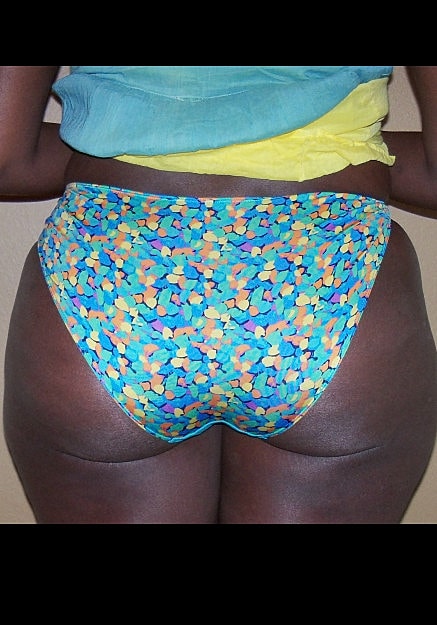Brazilian Butt Lift Before & After
