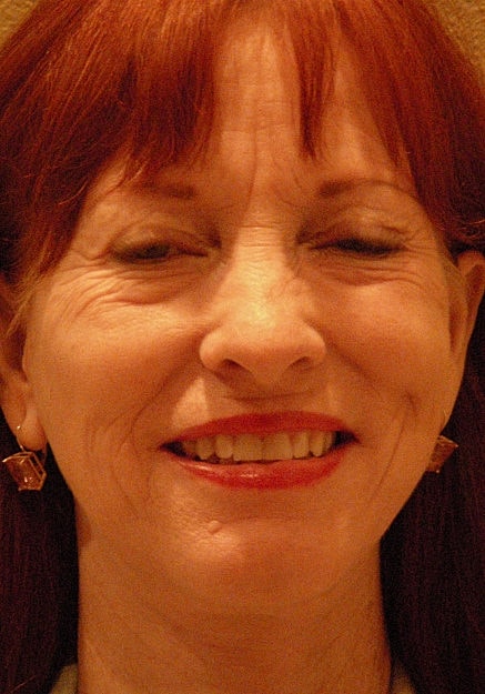 Facelift Before & After