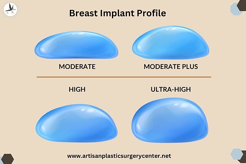 Breast implant profile comparison chart.