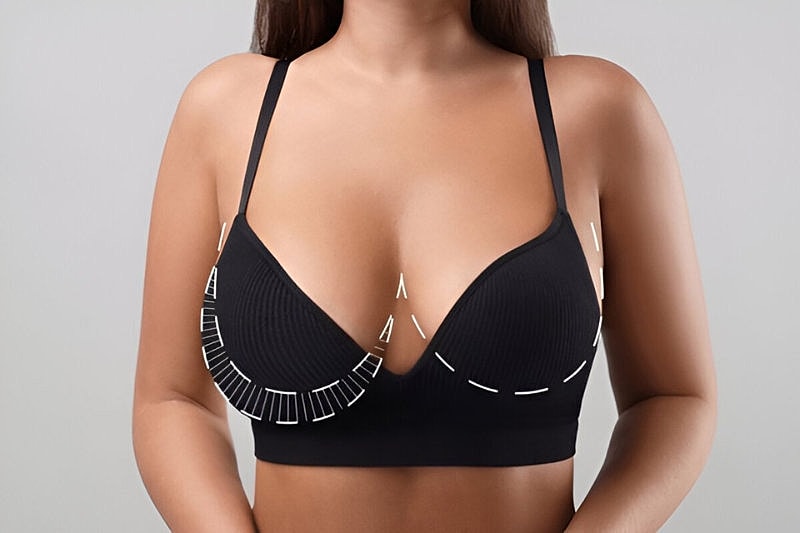Breast Surgery_ Breast Augmentation, Breast Implant Exchange, Breast Lift, Breast Reduction Male Breast Reduction