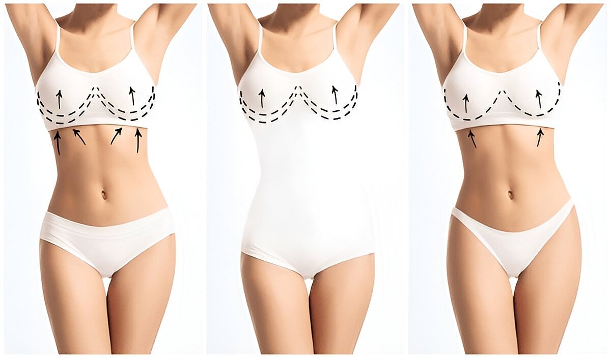 Breast Surgery_Patient Information - Access Plastic Surgery Patient Resources